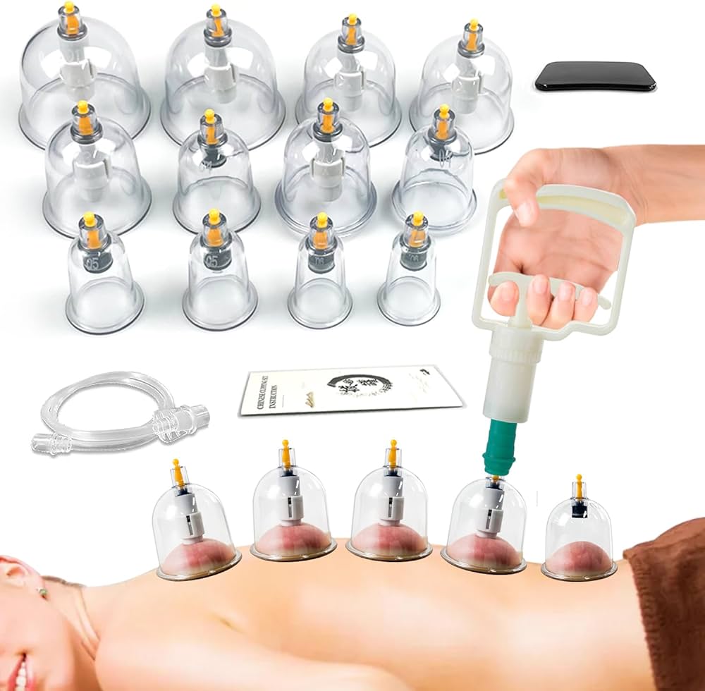 Cupping: características